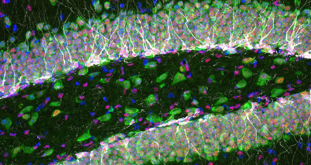 Quiz Scienza: i nostri neuroni si rinnovano?