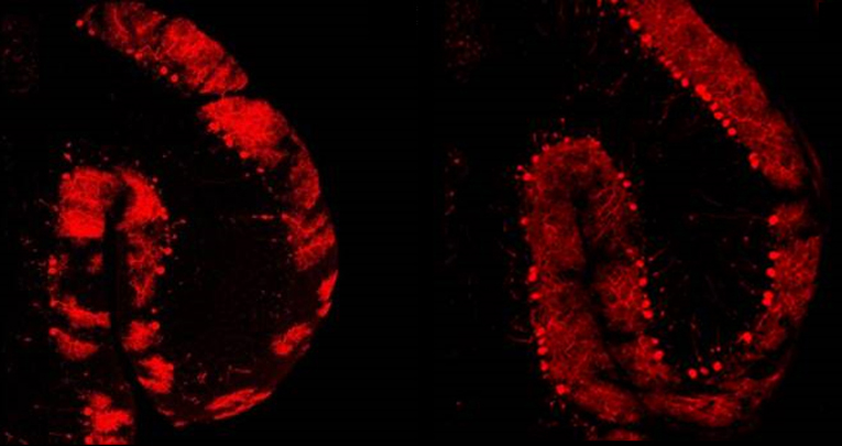 Preventive motor training but not progenitor grafting ameliorates cerebellar ataxia and deregulated autophagy in tambaleante mice.