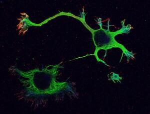 Connessioni che non ti aspetti tra inquinamento e cervello