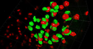 Vision4D - Analisi quantitativa delle immagini in 3D