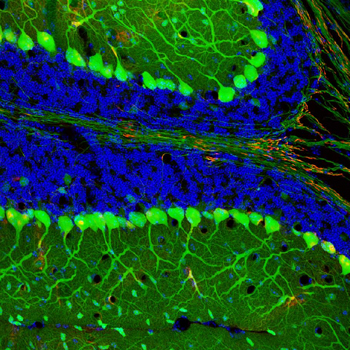 cerebellar_corticogenesis