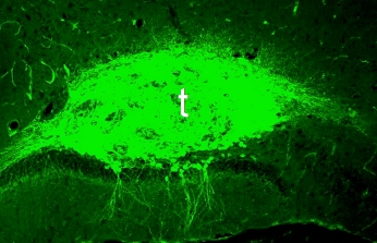 La-propagazione-dei-danni-cerebrali-nel-morbo-di-Alzheimer