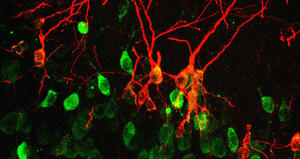 Neuroni-immaturi