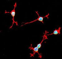 NG2_LMNB1_DAPI_vitro_piccola