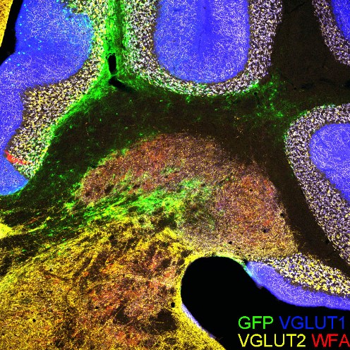 WFA-GFP-VGLUT1-VGLUT2