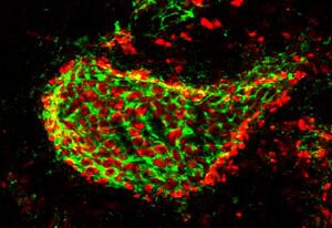 WFA+ perineuronal net (green) and synaptic terminals (red)