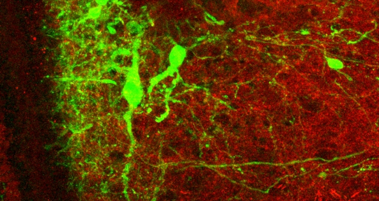 Giornata della Persona con Lesioni al Midollo Spinale: la scienza procede per piccoli passi Giornata della Persona con Lesioni al Midollo Spinale: la scienza procede per piccoli passi