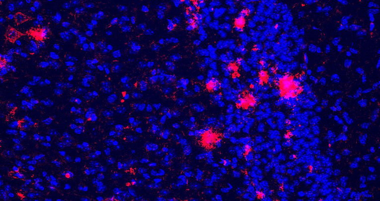 21 settembre, Giornata mondiale dell'Alzheimer