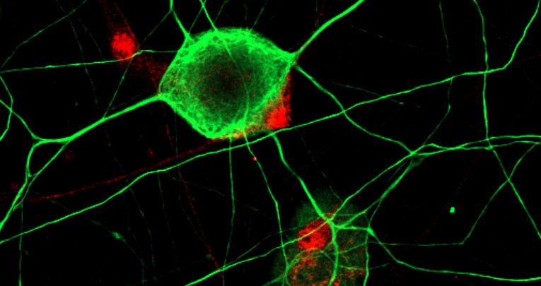 Nuovi orizzonti nella rigenerazione dei nervi: il futuro della ricerca Nuovi orizzonti nella rigenerazione dei nervi: il futuro della ricerca