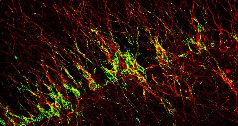 Plasticità cerebrale: una roba per giovani? Plasticità cerebrale: una roba per giovani?