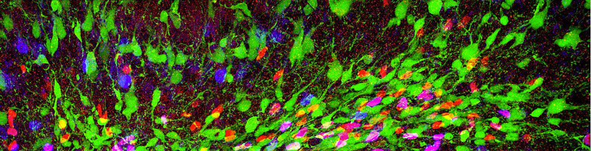 Physiopathology of neural stem cells