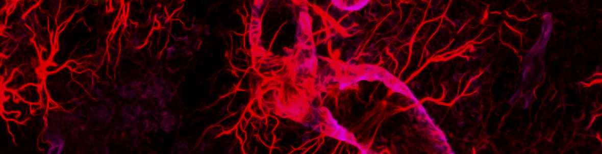 Aging and Alzheimer’s Disease Aging and Alzheimer’s Disease