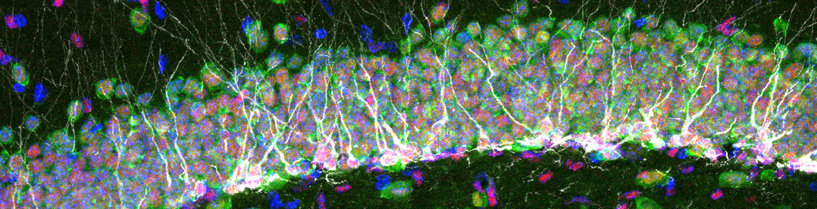 adult-neurogenesis_bonfanti adult-neurogenesis_bonfanti