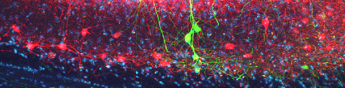brain-development_vercelli brain-development_vercelli