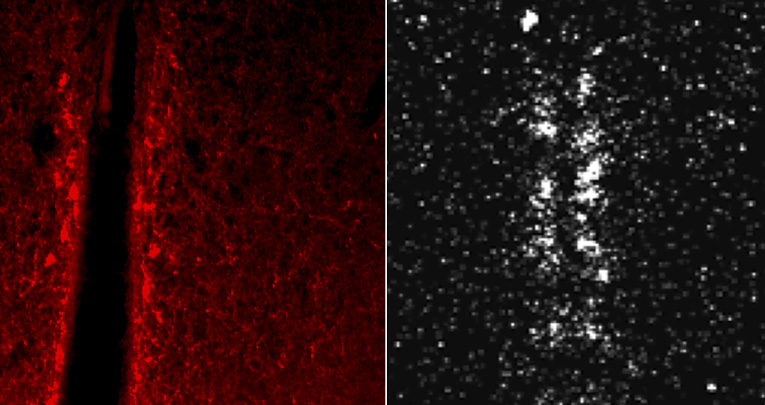 Environmentally Relevant Perinatal Exposures to Bisphenol A Disrupt Postnatal Kiss1/NKB Neuronal Maturation and Puberty Onset in Female Mice