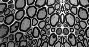 Elovl5 is required for proper action potential conduction along peripheral myelinated fibers 