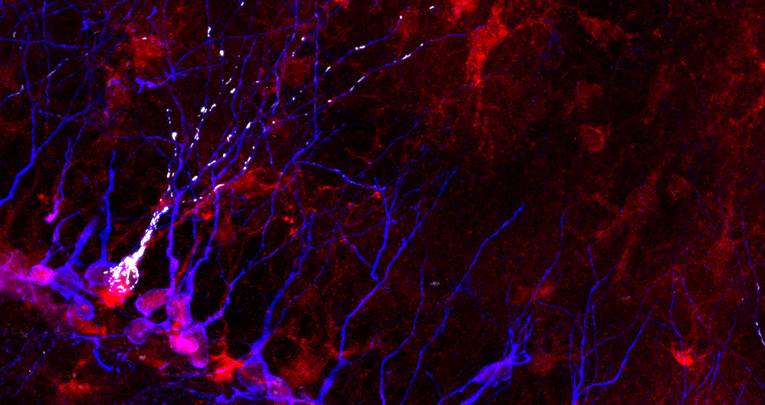 Intellectual disability: Sara Bonzano wins the post-doctoral grant from the Accademia dei Lincei to unveil novel etiopathogenetic mechanisms