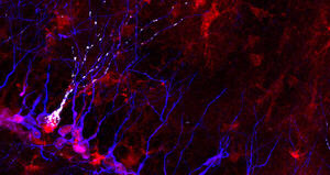 Intellectual disability: Sara Bonzano wins the post-doctoral grant from the Accademia dei Lincei to unveil novel etiopathogenetic mechanisms