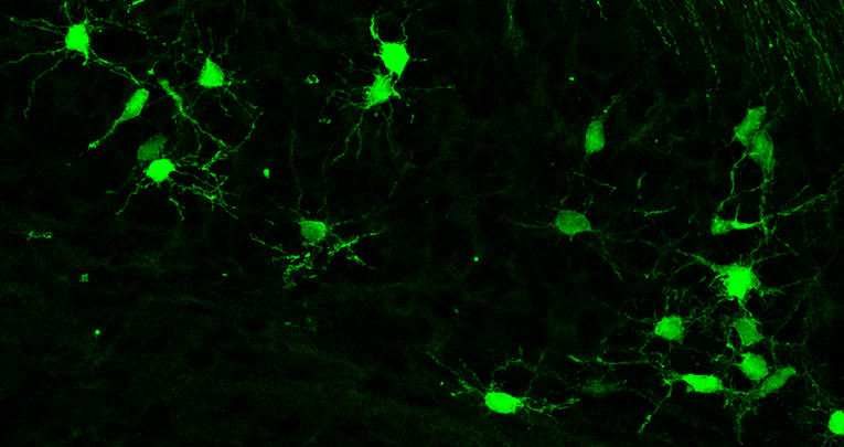 Automated segmentation of brain cells for clonal analyses in fluorescence microscopy images