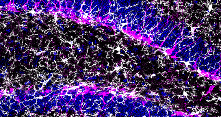 Effetti immunomodulatori del tamoxifene: implicazioni per il suo utilizzo nella ricerca biomedica Effetti immunomodulatori del tamoxifene: implicazioni per il suo utilizzo nella ricerca biomedica