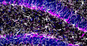 Effetti immunomodulatori del tamoxifene: implicazioni per il suo utilizzo nella ricerca biomedica