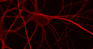 Giornata mondiale dell'Alzheimer: i nostri studi sul metabolismo del ferro