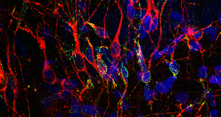 I neuroni immaturi preferiscono i cervelli grandi I neuroni immaturi preferiscono i cervelli grandi