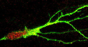 Brain Structural Plasticity: From Adult Neurogenesis to Immature Neurons