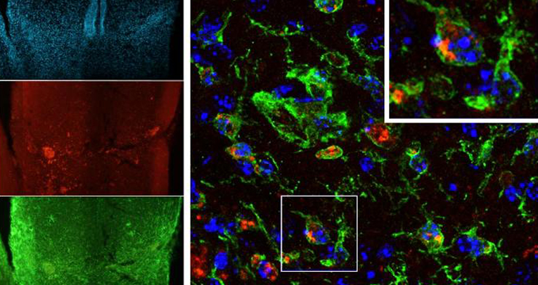 Imaging of Inflammation in Spinal Cord Injury: Novel Insights on the Usage of PFC-Based Contrast Agents Imaging of Inflammation in Spinal Cord Injury: Novel Insights on the Usage of PFC-Based Contrast Agents