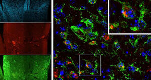 Imaging of Inflammation in Spinal Cord Injury: Novel Insights on the Usage of PFC-Based Contrast Agents