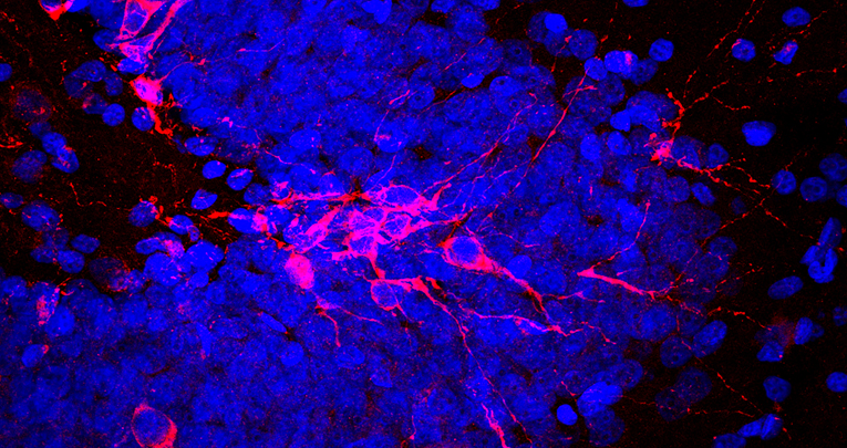 In cerca di alternative alla rigenerazione cerebrale In cerca di alternative alla rigenerazione cerebrale