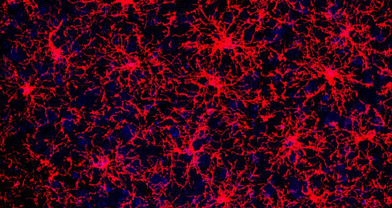 L'eredità nascosta delle cellule: nuova luce sui progenitori degli oligodendrociti