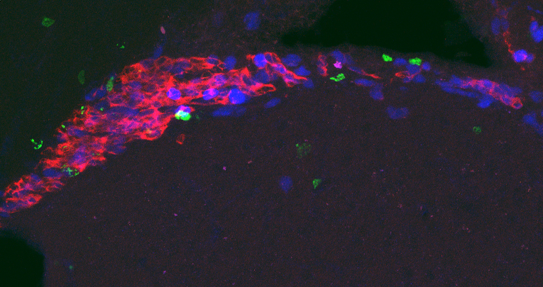 La complessa influenza degli ormoni sessuali sulla neurogenesi adulta nella zona sottoventricolare