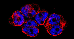 CITK loss inhibits growth of Group 3 and 4 medulloblastoma cells and sensitizes them to DNA-damaging agents.