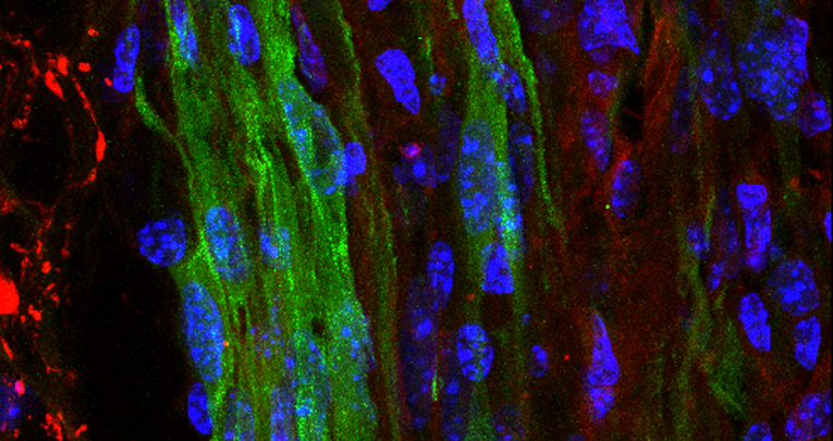 Lesioni midollari: nuova procedura di labelling per seguire il destino delle cellule trapiantate in vivo Lesioni midollari: nuova procedura di labelling per seguire il destino delle cellule trapiantate in vivo