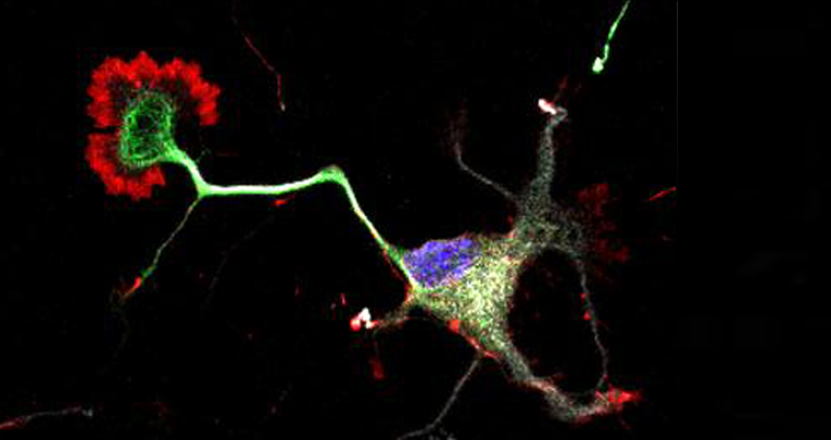 miR-7b-3p Exerts a Dual Role After Spinal Cord Injury, by Supporting Plasticity and Neuroprotection at Cortical Level