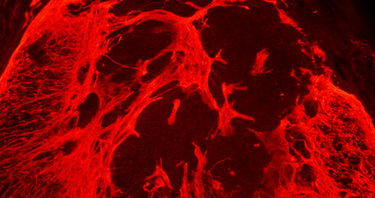 Functional integration of complex miRNA networks in central and peripheral lesion and axonal regeneration