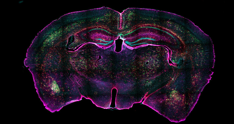 Sleep fragmentation affects glymphatic system through the different expression of AQP4 in wild type and 5xFAD mouse models