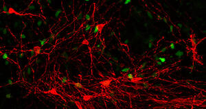 Stem Cell-Derived Human Striatal Progenitors Innervate Striatal Targets and Alleviate Sensorimotor Deficit in a Rat Model of Huntington Disease