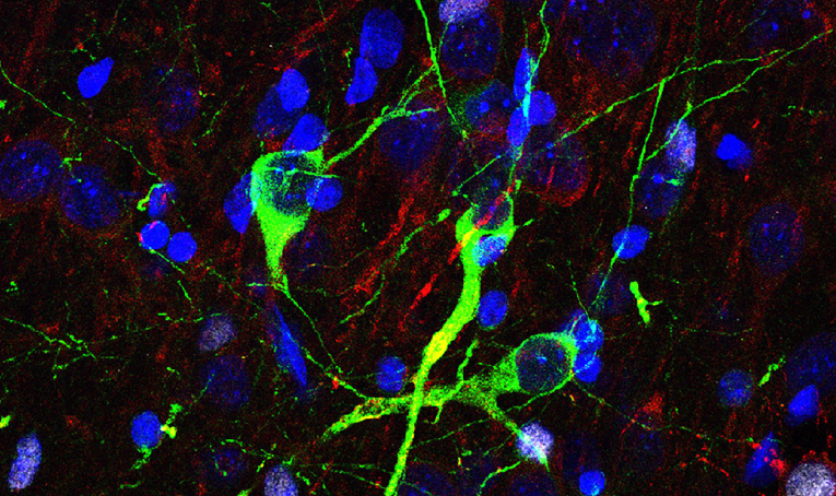 Adult neurogenesis and “immature” neurons in mammals: an evolutionary trade-off in plasticity?