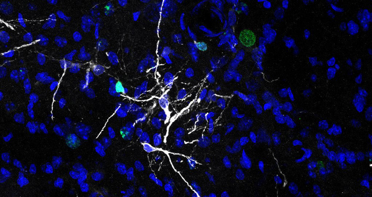 Adult Neurogenesis in Mammals: Variations and Confusions.