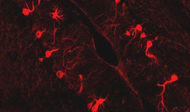 Neuropsychopharmacology, D. Carulli Neuropsychopharmacology, D. Carulli