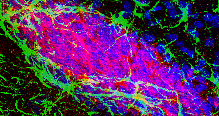 Plasticità cerebrale: buone e cattive notizie Plasticità cerebrale: buone e cattive notizie