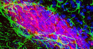 Plasticità cerebrale: buone e cattive notizie