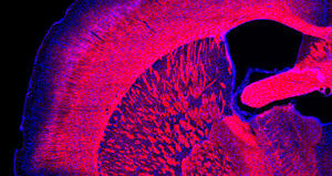 Plasticità della mielina nel cervello adulto: substrato dell’apprendimento e della memoria?