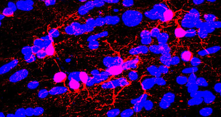 Air pollution and Multiple Sclerosis: PM effects on neuroinflammation and myelin repair