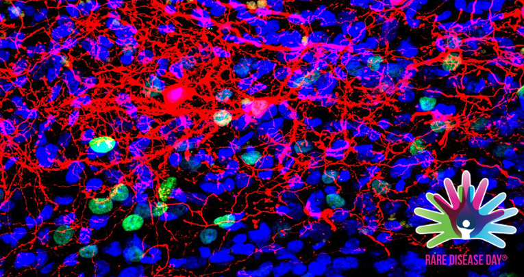 Rare Disease Day: le ricerche del NICO dedicate alla malattia di Huntington Rare Disease Day: le ricerche del NICO dedicate alla malattia di Huntington