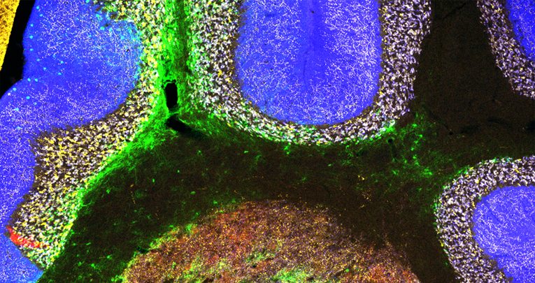 Cerebellar plasticity and associative memories are controlled by perineuronal nets Cerebellar plasticity and associative memories are controlled by perineuronal nets