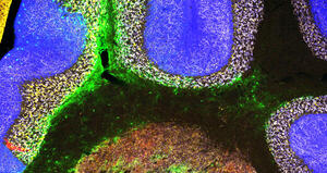 Cerebellar plasticity and associative memories are controlled by perineuronal nets