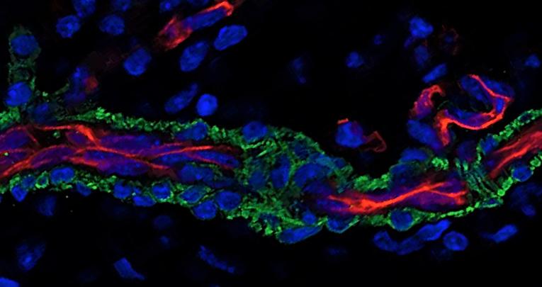 Blood Vessels: The Pathway Used by Schwann Cells to Colonize Nerve Conduits